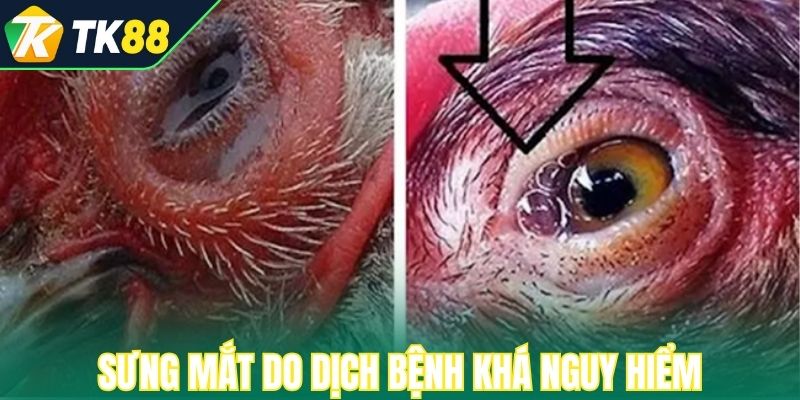 Sưng mắt do dịch bệnh khá nguy hiểm